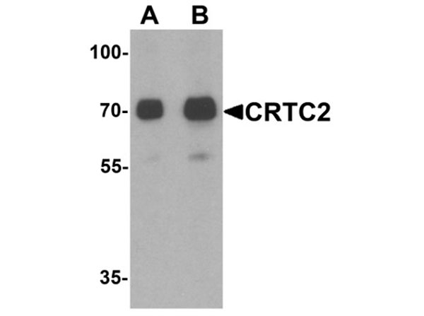 Western blot of CRTC2