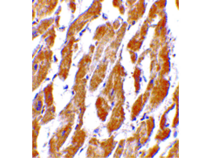 Immunohistochemistry of CRTH2 Antibody