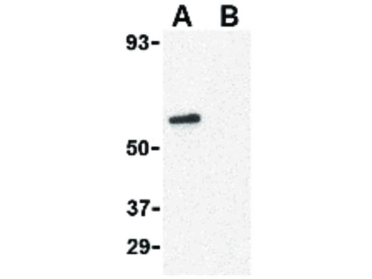 Western Blot of CRTH2 Antibody