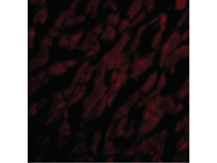 Immunofluorescence of CRTH2 Antibody