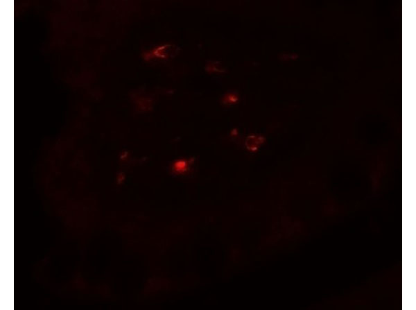 Immunofluorescence of CTHRC1