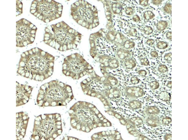 Immunohistochemistry of CTHRC1