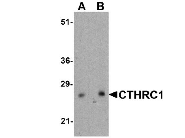 Western blot of CTHRC1