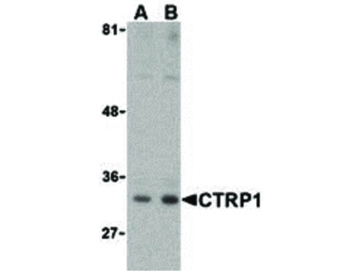 Western Blot of CTRP1 Antibody
