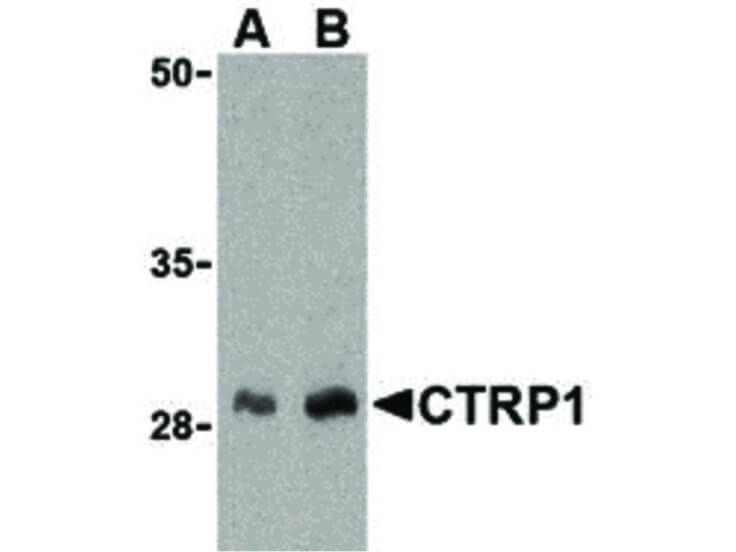 Western Blot of CTRP1 Antibody