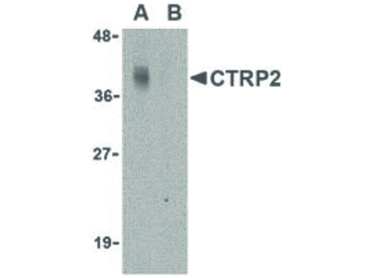Western Blot of CTRP2 Antibody