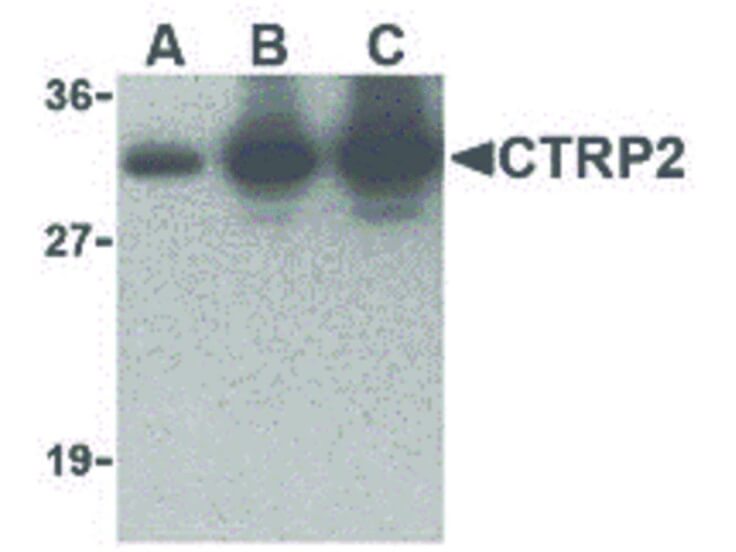 Western Blot of CTRP2 Antibody