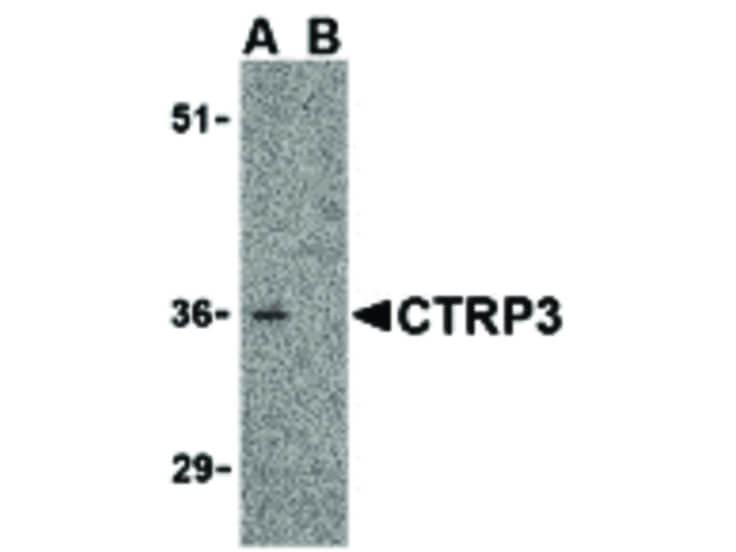 Western Blot of CTRP3 Antibody
