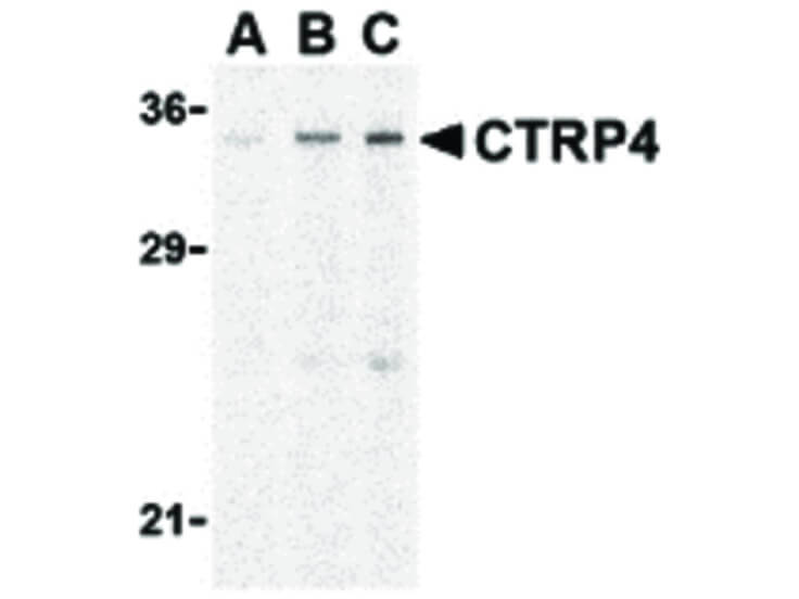 Western Blot of CTRP4 Antibody