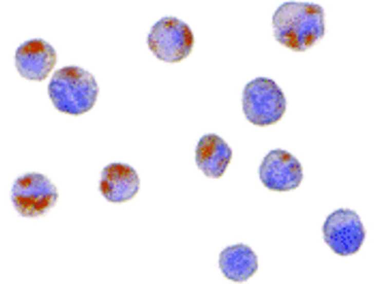 Immunocytochemistry of CTRP6 Antibody