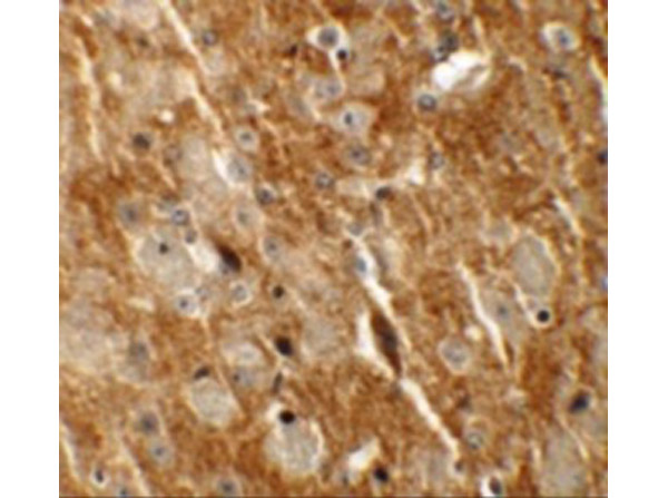 Immunohistochemistry of CTNNBL1