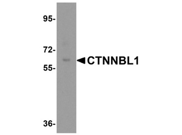 Western blot analysis of CTNNBL1