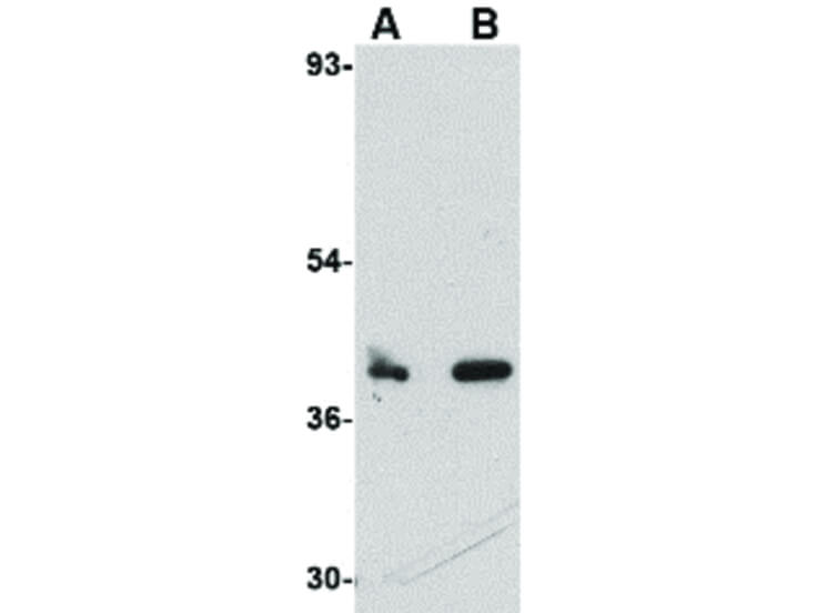 Western Blot of CUEDC1 Antibody