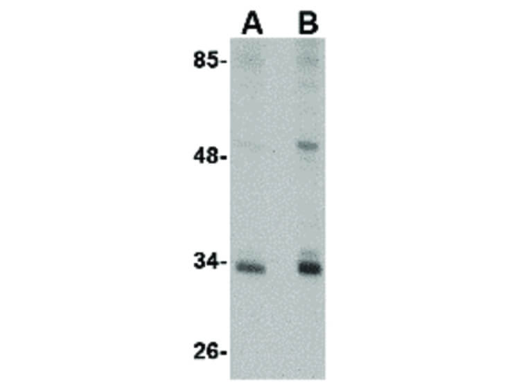 Western Blot of CUEDC2 Antibody