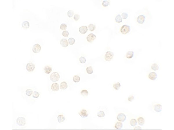 Immunocytochemistry of CXCL12