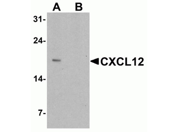 Western blot of CXCL12