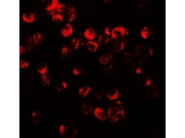 Immunofluorescence of CXCR3