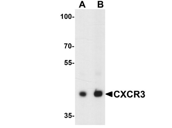 Western blot of CXCR3