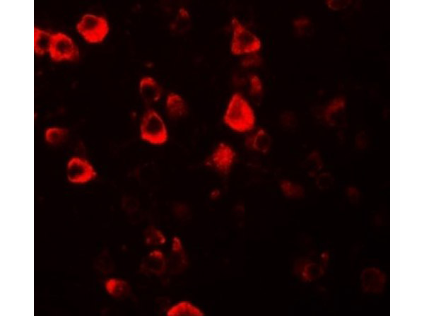 Immunofluorescence of CXXC4