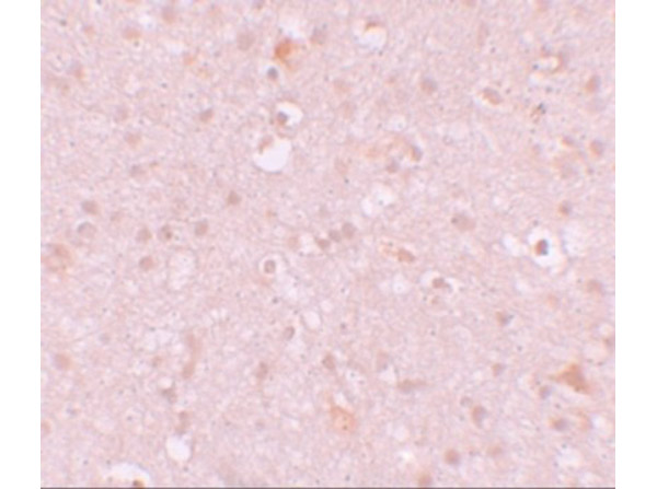 Immunohistochemistry of CXXC4