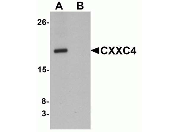 Western blot analysis of CXXC4