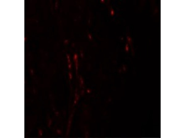 Immunofluorescence of CXXC5