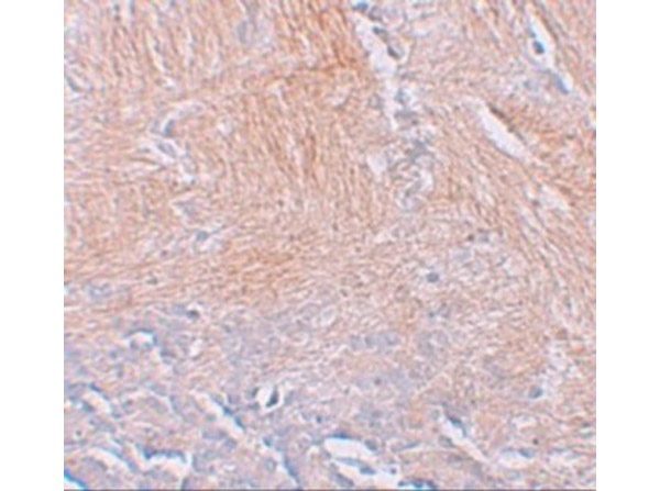 Immunohistochemistry of CXXC5