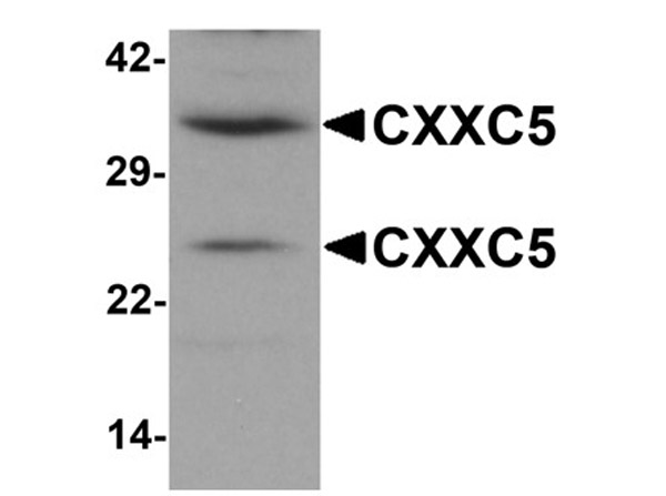 Western blot analysis of CXXC5