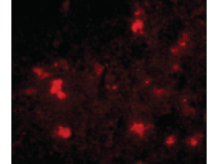 Immunofluorescence of Dact2 Antibody