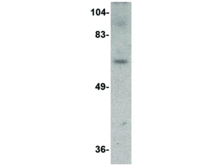 Western Blot of Dact3 Antibody