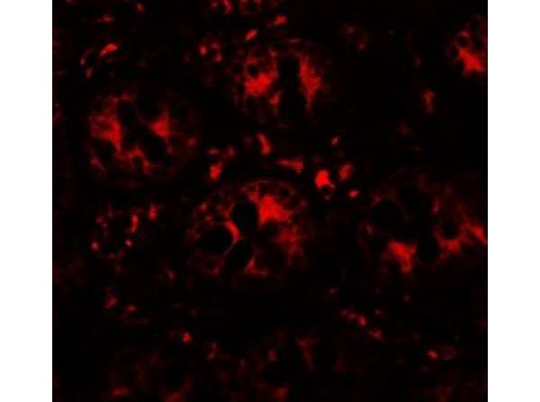 Immunofluorescence of DAP