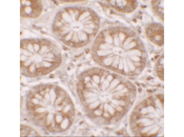 Immunohistochemistry of DAP