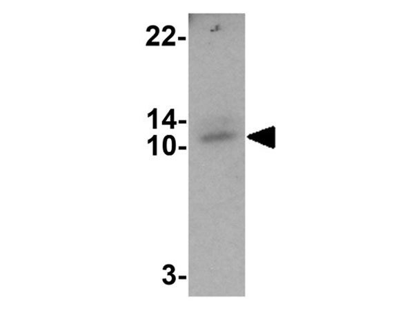 Western blot of DAP
