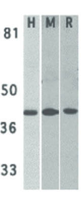 Western Blot of DAPK2 Antibody