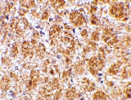 Immunohistochemistry of DARC