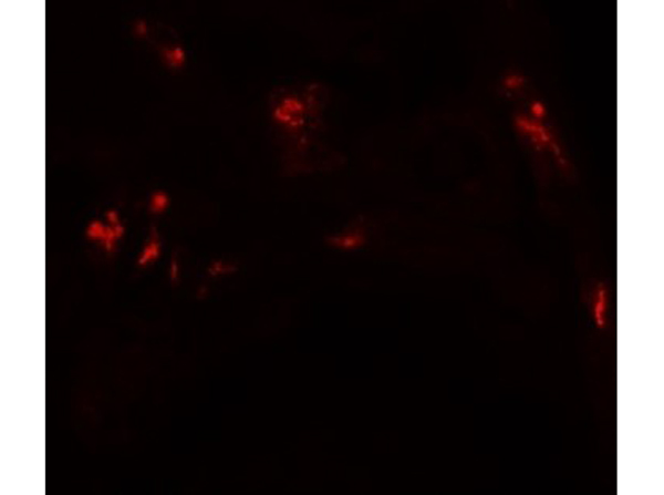 Immunofluorescence of DBX1