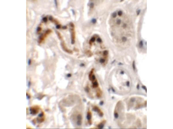 Immunohistochemistry of DBX1