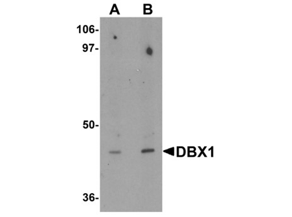 Western blot analysis of DBX1