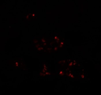 Immunofluorescence of DBX2