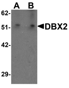 Western blot analysis of DBX2