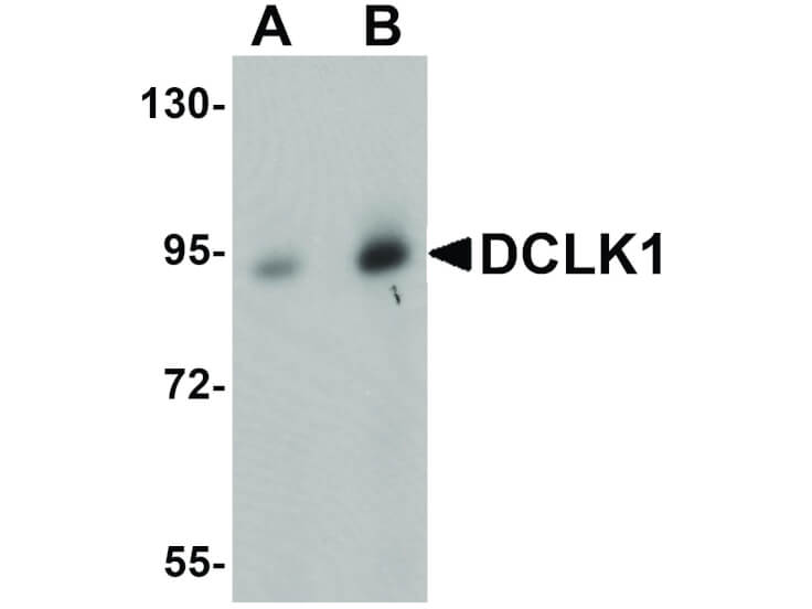 Western Blot of DCLK1 Antibody