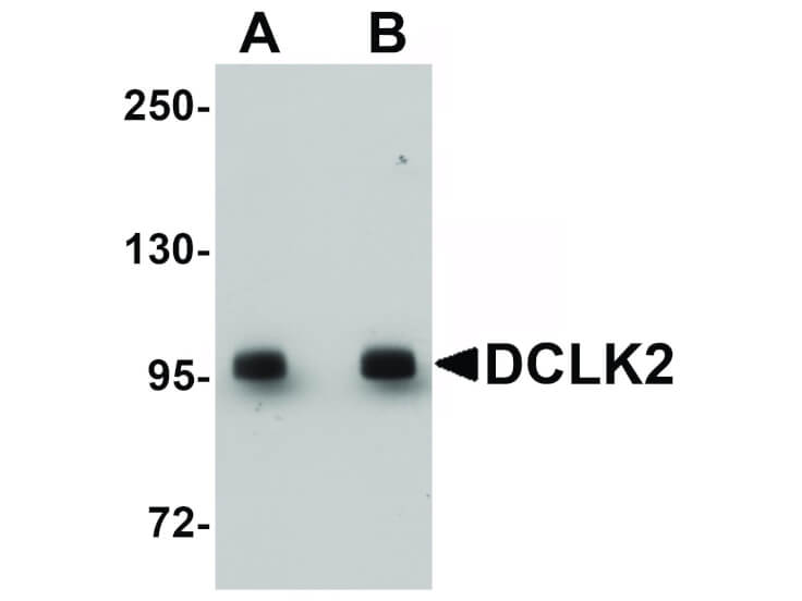 Western Blot of DCLK2 Antibody