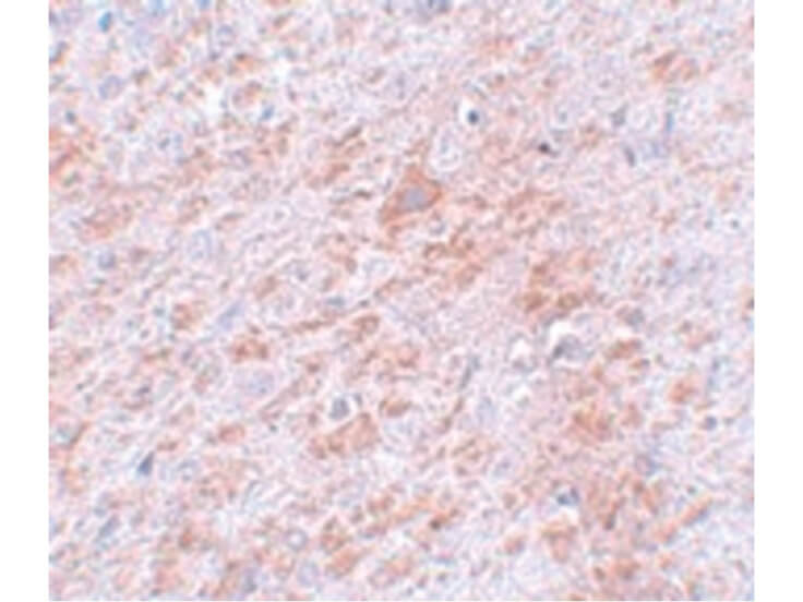 Immunohistochemistry of DCLK2 Antibody