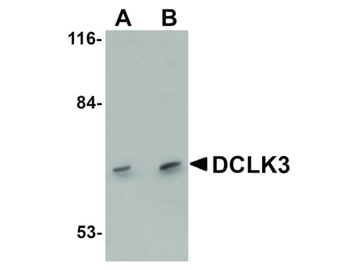Western Blot of DCLK3 Antibody