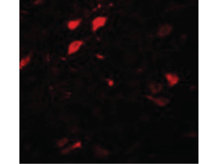 Immunofluorescence of DCLK3 Antibody