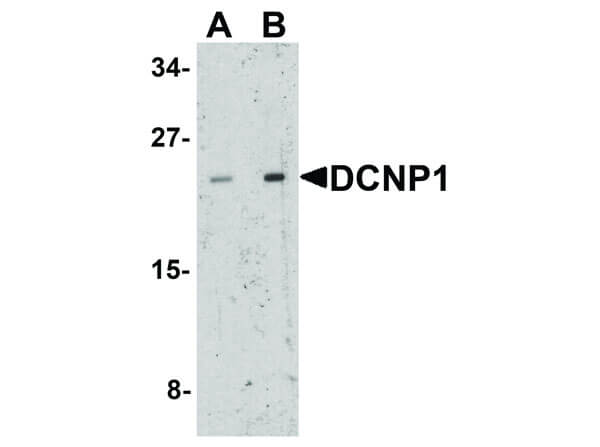 Western Blot of DCNP1 Antibody