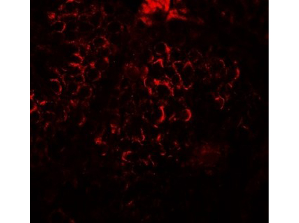 Immunofluorescence of DCP2