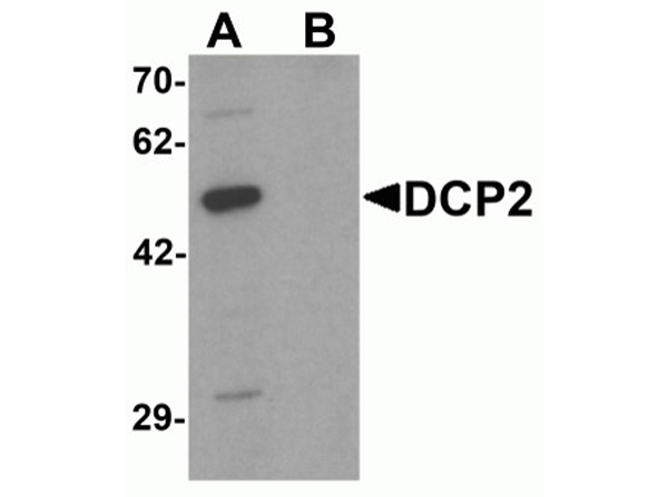 Western blot analysis of DCP2
