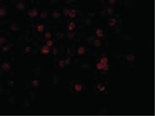 Immunofluorescence of DcR1 Antibody