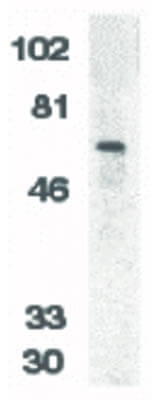 Western Blot of DcR1 Antibody